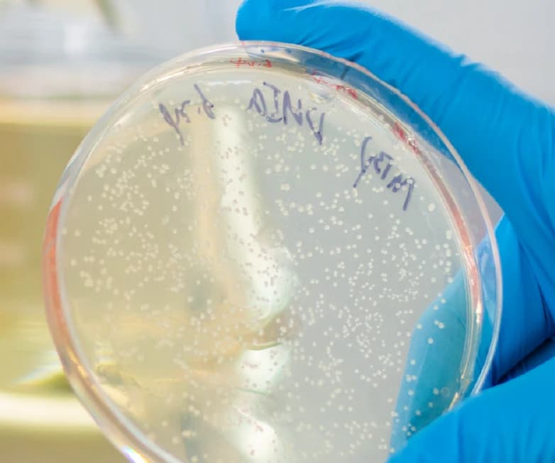 Agar plate with single colonies from a prokaryotic expression experiment