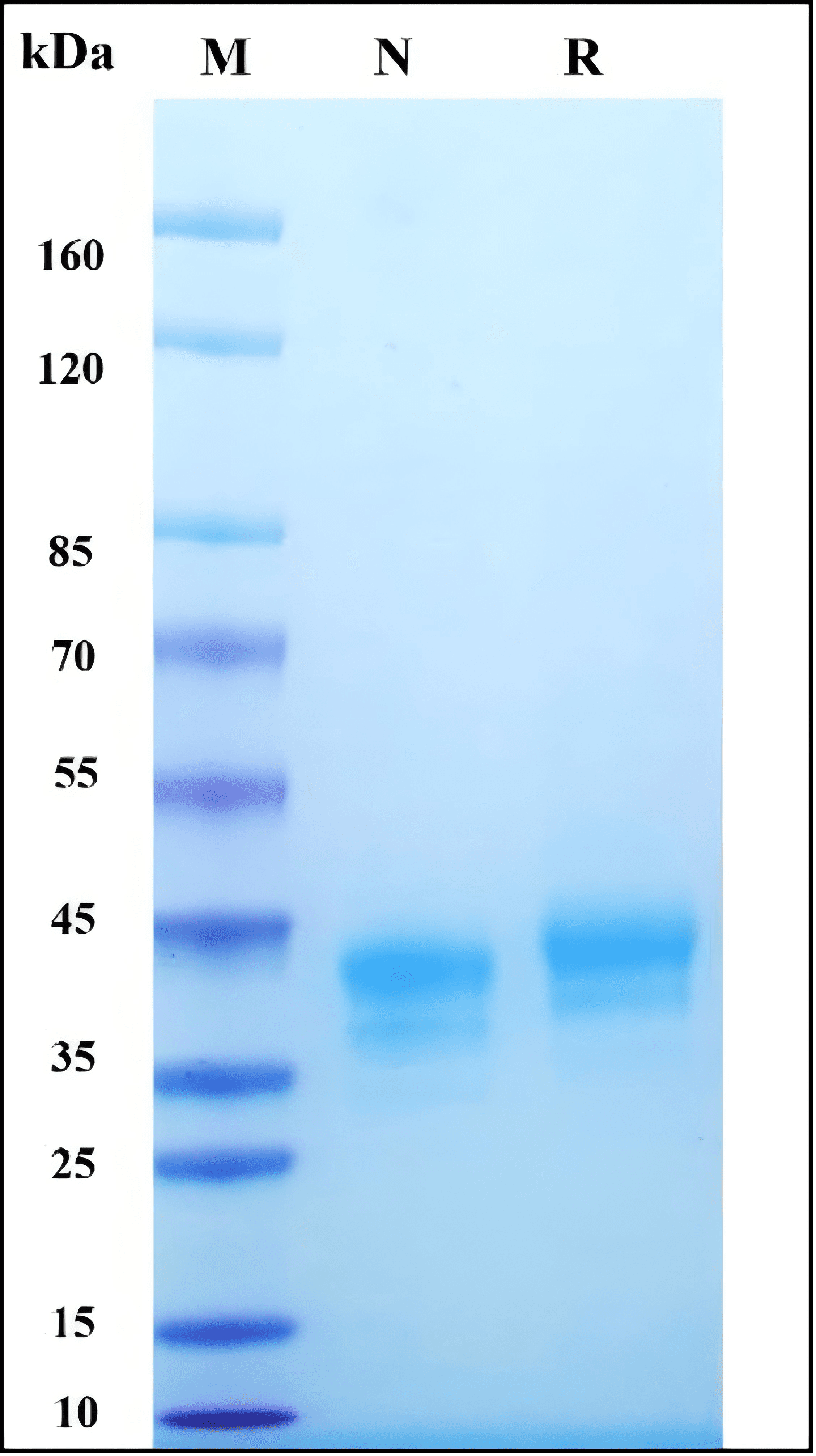 Recombinant Human FRα Protein, Avi-His Tag