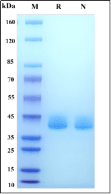 SDS-PAGE purity verification illustration (placeholder, pending client replacement)