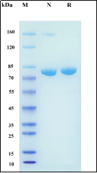 SDS-PAGE purity verification illustration (placeholder, pending client replacement)