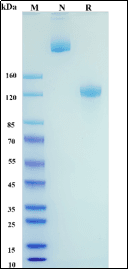 SDS-PAGE purity verification illustration (placeholder, pending client replacement)