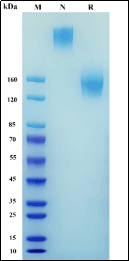 Recombinant Human CEACAM-5/CD66e Protein, hFc Tag