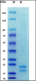 Recombinant Human IL-17A/CTLA-8 Protein, Avi-His Tag