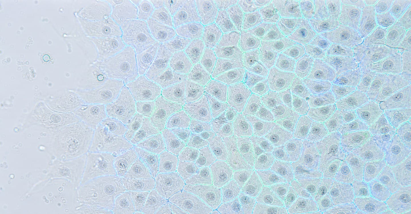 Micrograph of an adherent cell monolayer